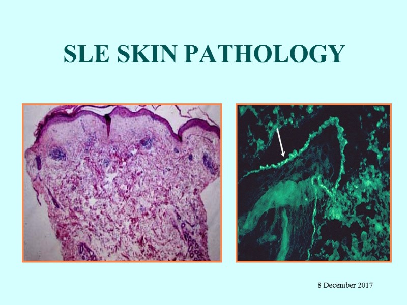 SLE SKIN PATHOLOGY 8 December 2017